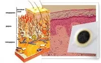 Пластир від гіпертонії (тиску) Hypertension Patch з Китаю склад, як діє, відгуки лікарів гіпертонії