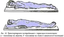 Перелом хребта та тазу перелом