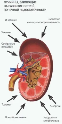 Ниркова недостатність симптоми та лікування лікування