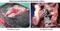 глисти