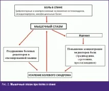 Підходи до лікування болю в спині #04 спині