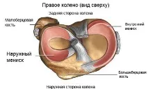 Пошкодження меніска колінного суглоба лікування, симптоми симптоми