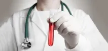 RDW - interpretare test de sânge, normă