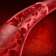 Системний васкуліт фото, діагностика, симптоми та лікування, прогноз діагностика