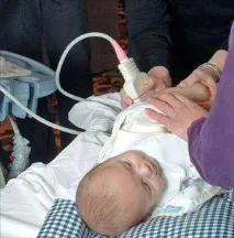 УЗД для новонароджених новонароджених