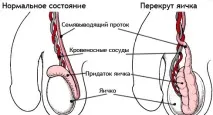 методи