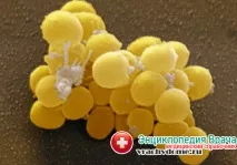 Ячмінь у дитини нетрадиційні методи лікування методи