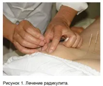 Здоров’я на кінчику голки здоров