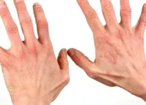 shellac