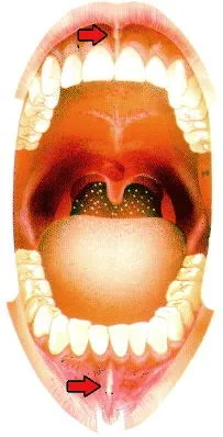 Просте та складне видалення зубів кореня