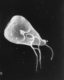 Лямбліоз. Аналіз на антитіла до Giardia lamblia (збуднику лямбліозу) антитіла