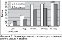 ендопротезиране