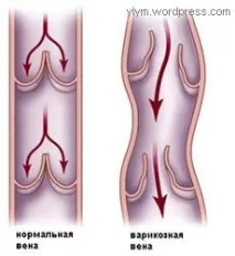 фитотерапия