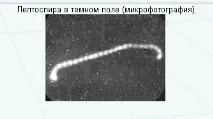 Метод розчавленої краплі розчавленої