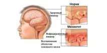 харчування