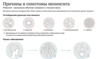 менінгіт