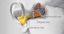 Лабіринтит причини, симптоми, лікування симптоми
