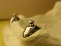 штифтова