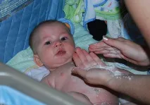 Попрілості у дітей шкіру