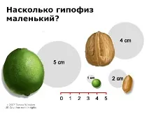 Пухлини гіпофіза симптоми та діагностика гіпофіза