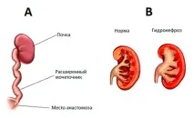 време