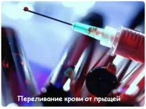 Переливання крові від прищів крові