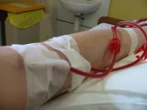 Ниркованедостатність виявлення, діагностика, лікування ниркованедостатність