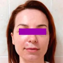 Пілінг від Зейна Обаджі зейна