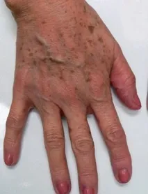 шкіри