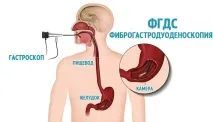 вони