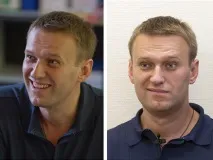 Правильний Навальний • • Блог Хірургія стилю правильний