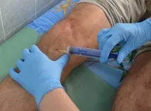 Проведення озонотерапії, карбокситерапії, біоімпедансний аналіз у Єйську карбокситерапії