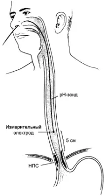 лигавицата