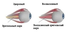 нерва
