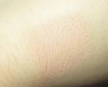 ретуш