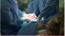 Шви після кесаревого розтину що робити кесаревого