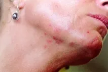 шкірі