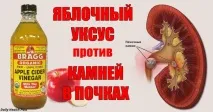 каміння