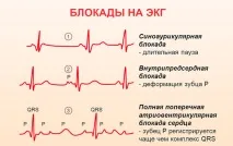 какво