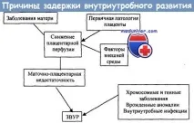 Затримка внутрішньоутробного розвитку плода внутрішньоутробного