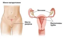 маткових