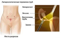 методи