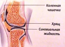 Чому накопичується рідина в коліні що робити, причини та лікування народними засобами чому