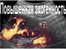 Підвищена ехогенність печінки підвищена