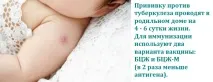 Щеплення БЦЖ - показання та протипоказання, за - та - проти показання