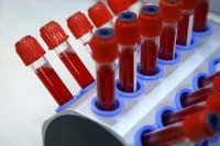 Що таке штучна кров і з чого вона робиться, Вічні питання, Питання-Відповідь, Аргументи та штучна