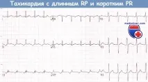 прехода