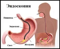 хронічний