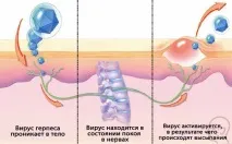герпес