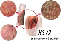 жінок